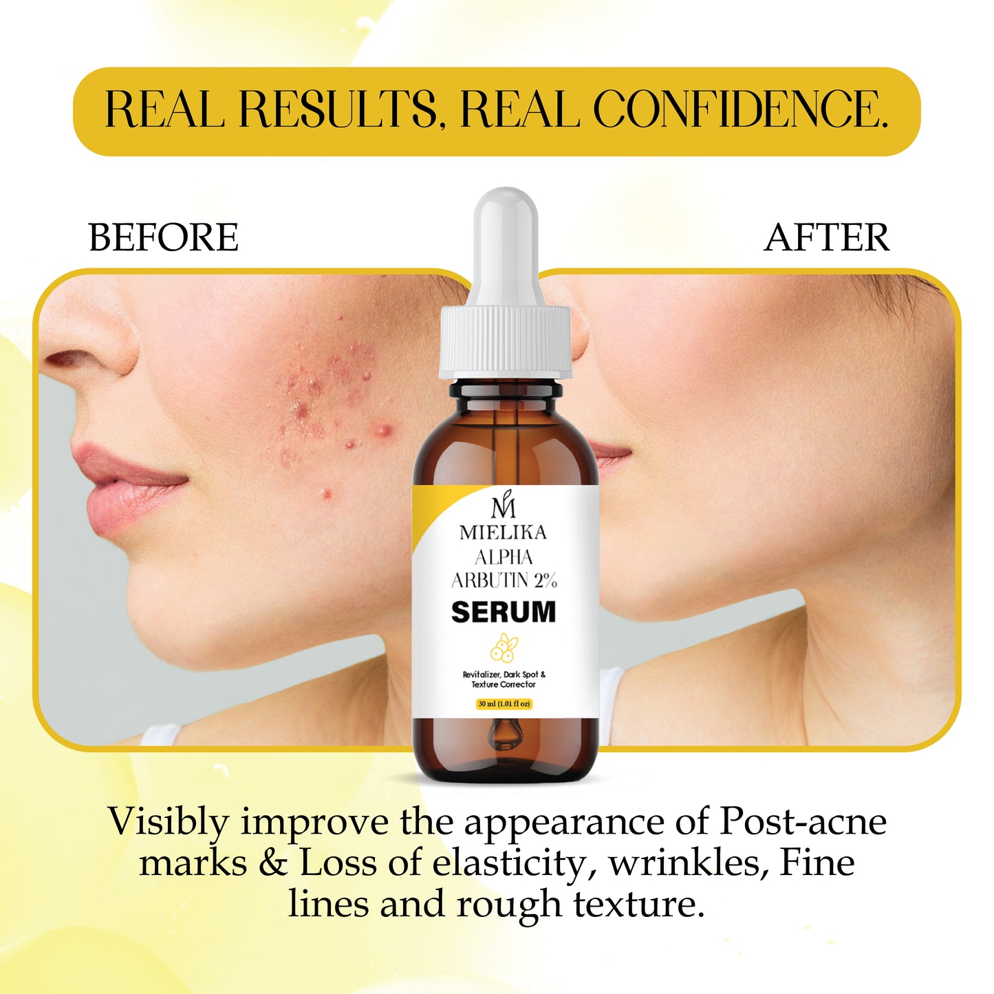 Alpha Arbutin Serum for Skin Brightening | Dark Spot Remover | Even Skin Tone & Radiance | Lightweight, Fast Absorbing Face Serum