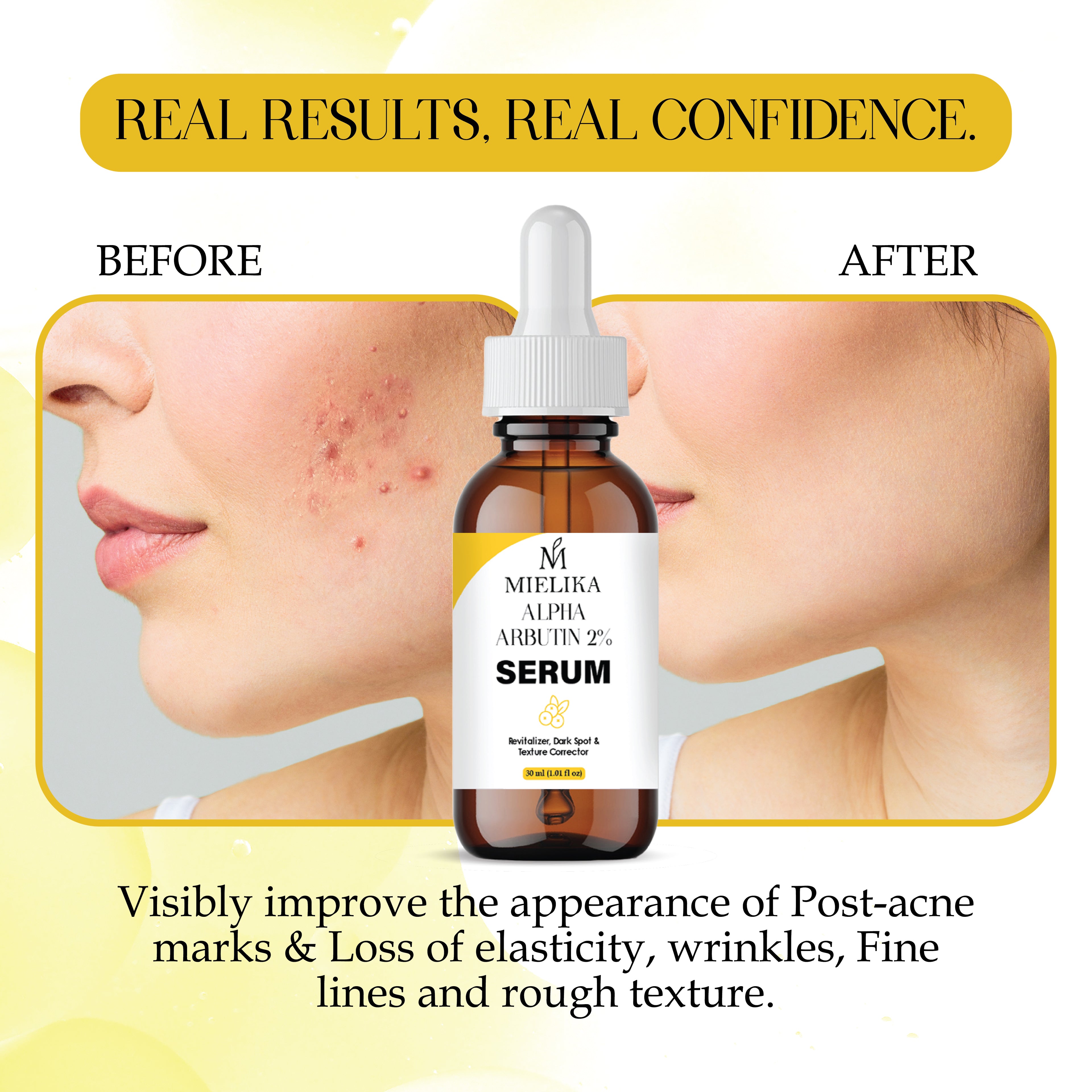 Alpha Arbutin Serum for Skin Brightening | Dark Spot Remover | Even Skin Tone & Radiance | Lightweight, Fast Absorbing Face Serum