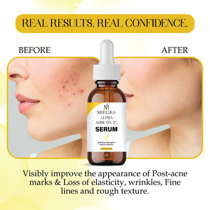 Alpha Arbutin Serum for Skin Brightening | Dark Spot Remover | Even Skin Tone & Radiance | Lightweight, Fast Absorbing Face Serum