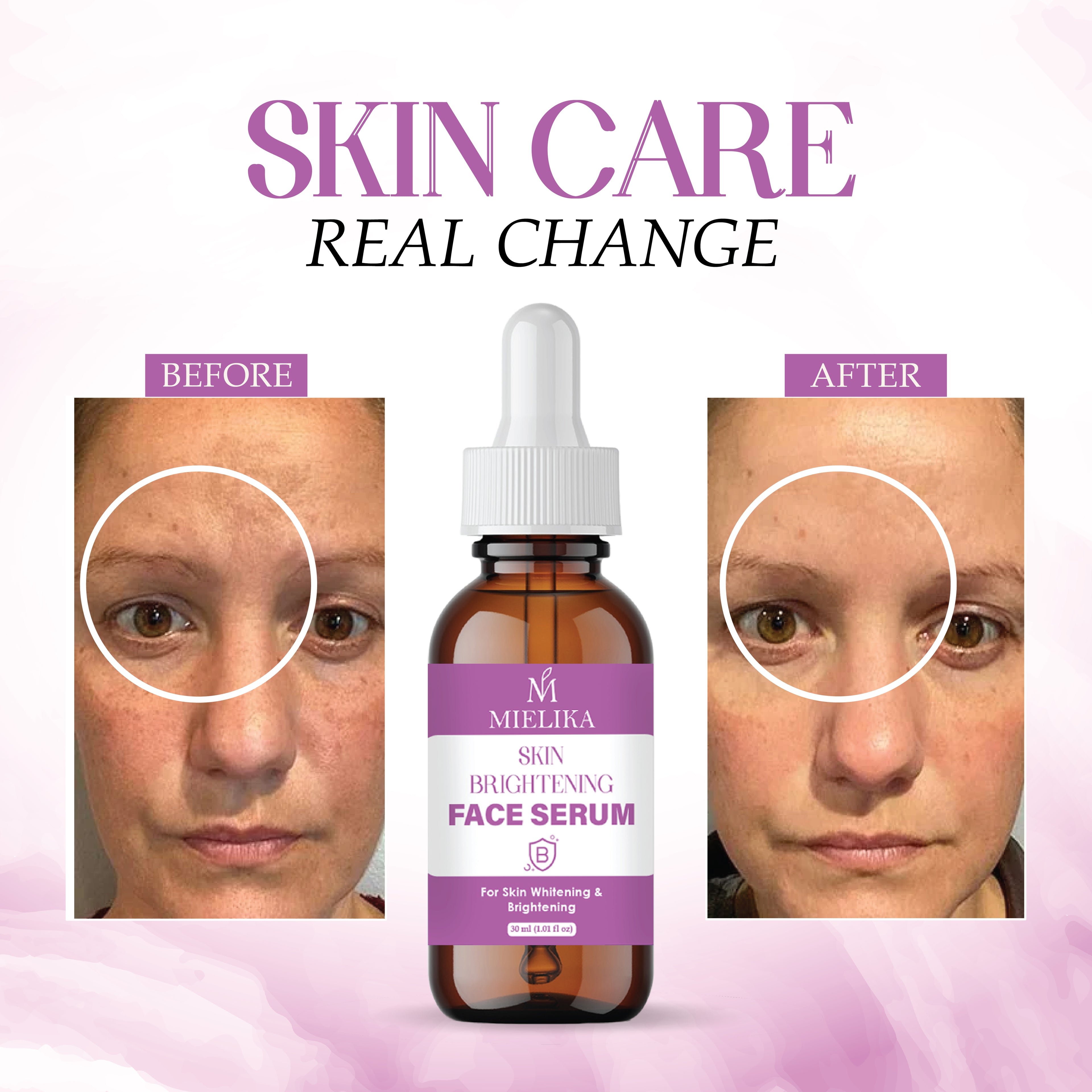 Skin Brightening Serum with Vitamin C, Niacinamide & Hyaluronic Acid | Dark Spot Corrector | Evens Skin Tone | Hydrating Face Serum for Radiant & Glowing Skin – 30ml