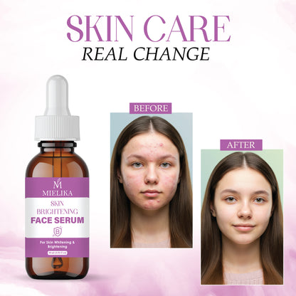 Skin Brightening Serum with Vitamin C, Niacinamide & Hyaluronic Acid | Dark Spot Corrector | Evens Skin Tone | Hydrating Face Serum for Radiant & Glowing Skin – 30ml